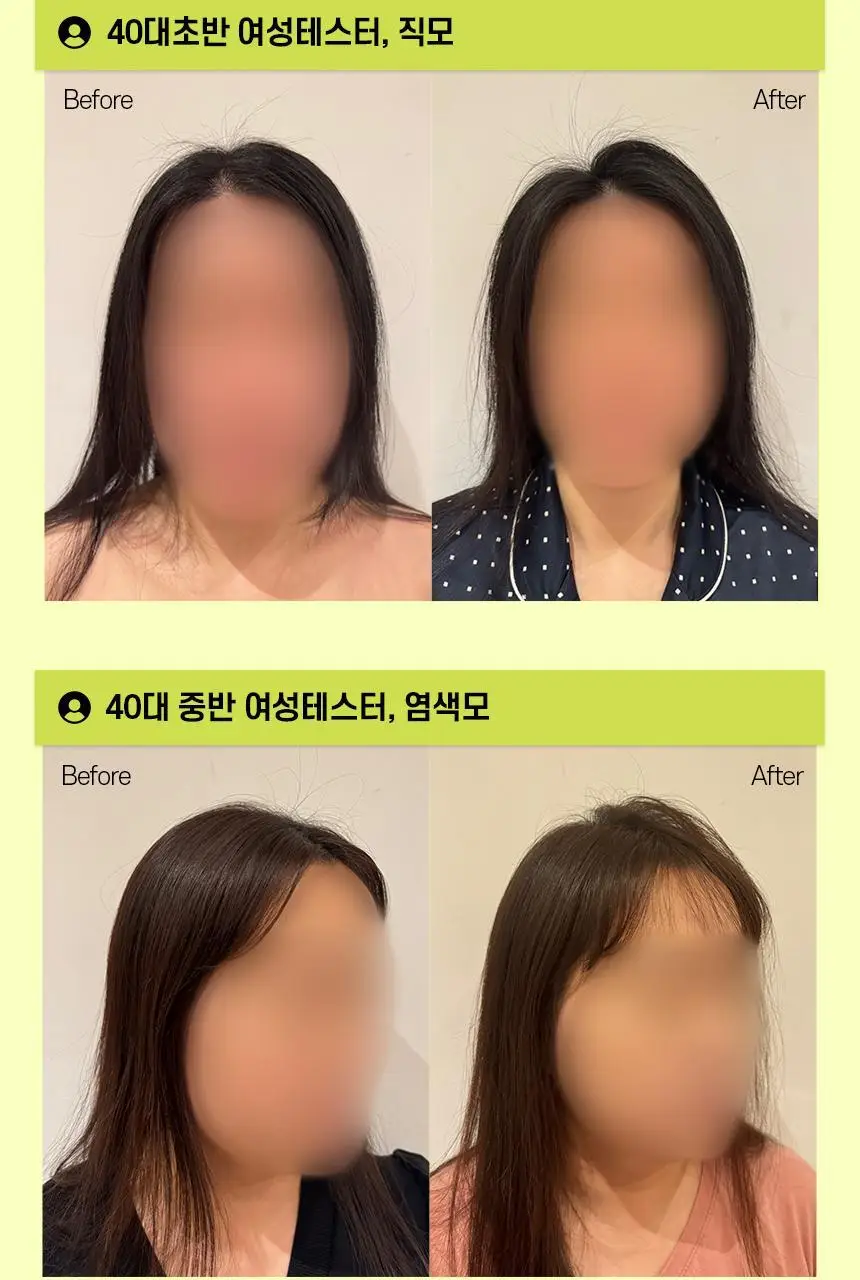 [카이스트특허기술] 그래비티 헤어리프팅 샴푸 스트롱 475ml (단품/증정기획) 상세페이지 22